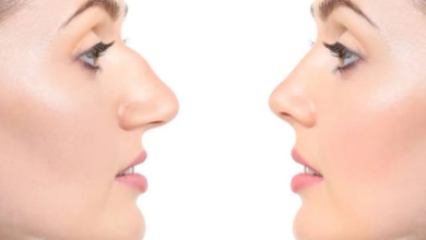 Ready to Transform Your Appearance With a Nose Surgery in Dubai?