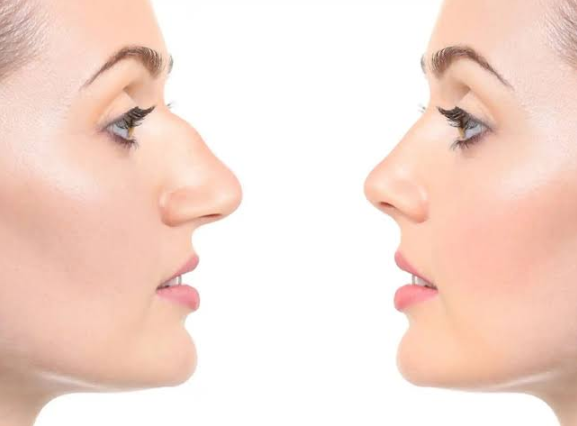 Ready to Transform Your Appearance With a Nose Surgery in Dubai?