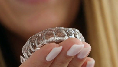 Clear Aligners