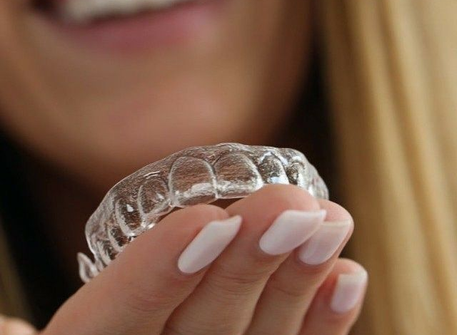 Clear Aligners